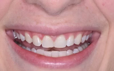 Awesome Smile