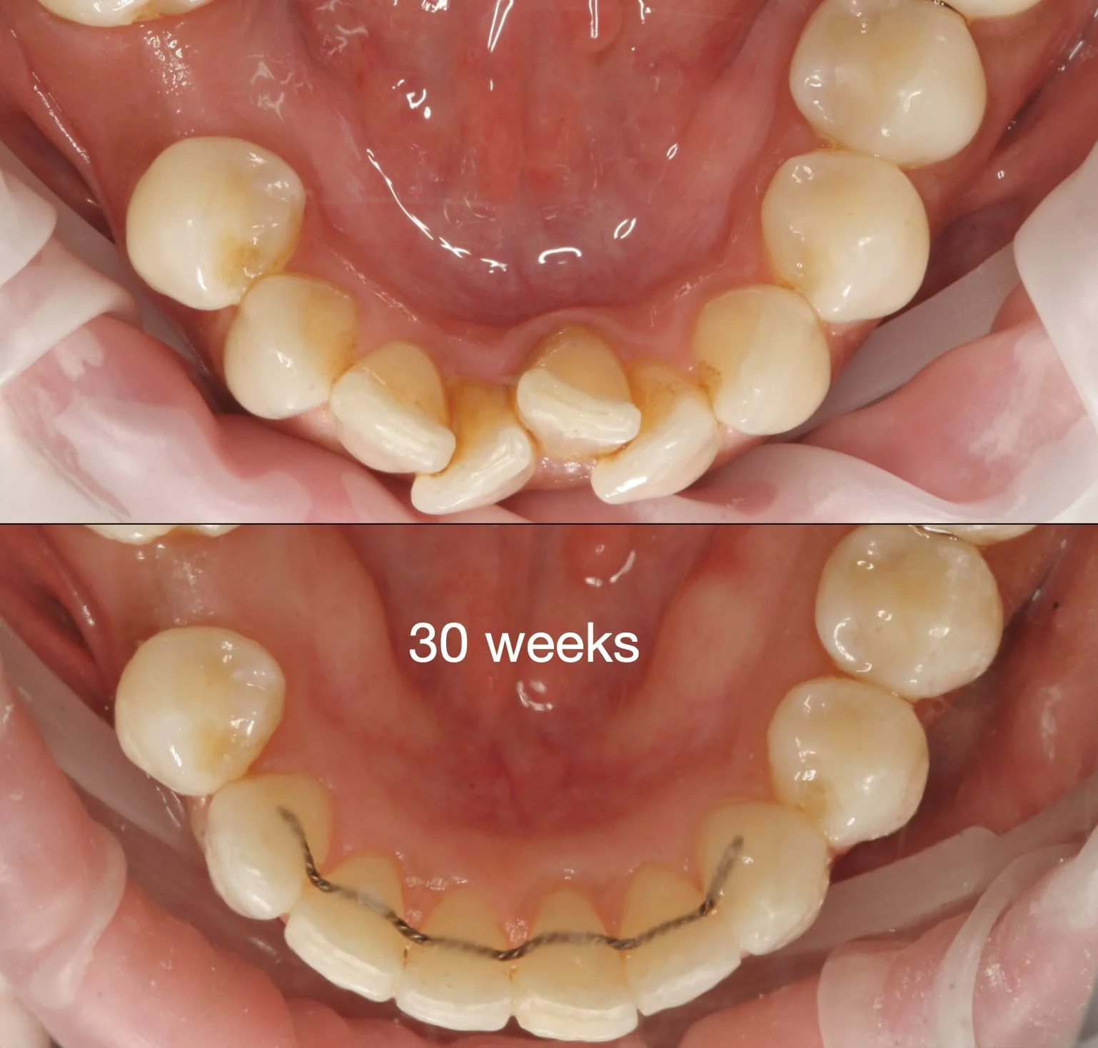 dentures Nunawading