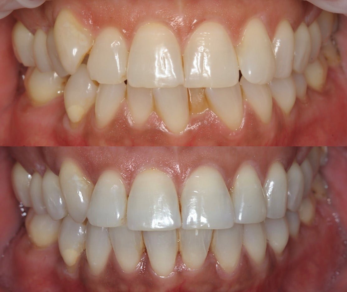 Nunawading dentures