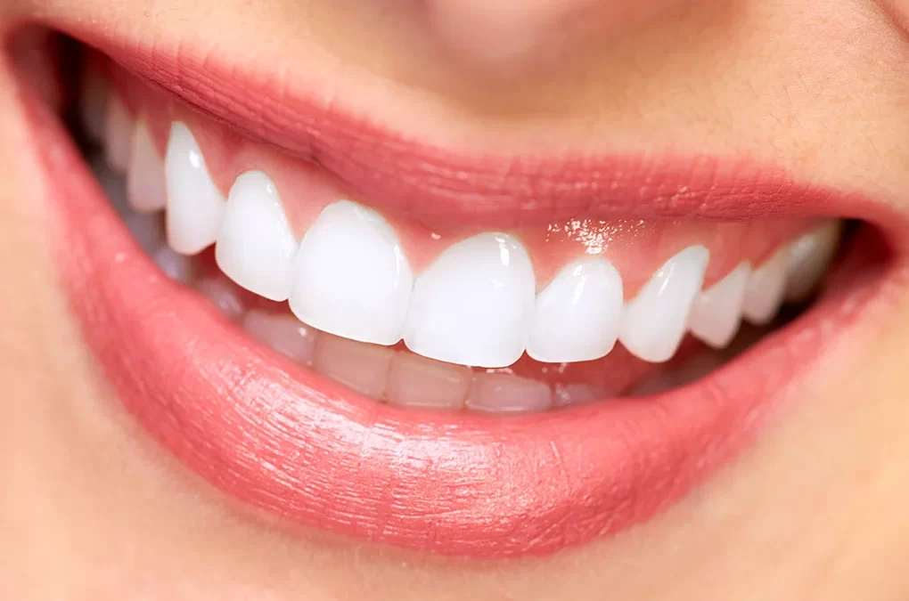 How Porcelain Veneers Can Give You a Stunning, Natural-Looking Smile