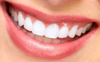 How Porcelain Veneers Can Give You a Stunning, Natural-Looking Smile