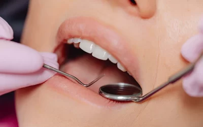 CEREC An advanced technology for Same Day Dentistry