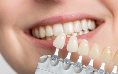 Can Resin Bonding Whiten Your Smile? The Surprising Benefits of This Treatment