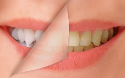The TikTok Whitening Hacks That Could Do More Harm Than Good